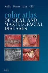 Book cover of Color Atlas of Oral and Maxillofacial Diseases - E-Book by Brad W. Neville DDS