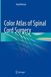 Book cover of Color Atlas of Spinal Cord Surgery by Jörg Klekamp