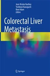 Book cover of Colorectal Liver Metastasis by Jean-Nicolas Vauthey