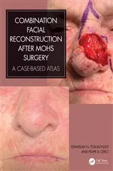 Book cover of Combination Facial Reconstruction after Mohs Surgery by Stanislav N. Tolkachjov