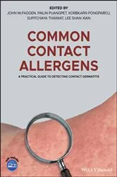 Book cover of Common Contact Allergens by Unknown