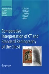 Book cover of Comparative Interpretation of CT and Standard Radiography of the Chest by Emmanuel E. Coche