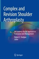 Book cover of Complex and Revision Shoulder Arthroplasty by Unknown