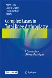 Book cover of Complex Cases in Total Knee Arthroplasty by Alfred J. Tria