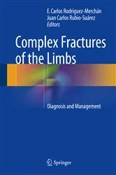 Book cover of Complex Fractures of the Limbs by Unknown