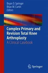 Book cover of Complex Primary and Revision Total Knee Arthroplasty by Bryan D. Springer