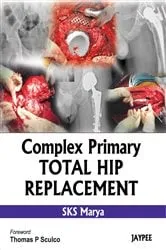 Book cover of Complex Primary Total Hip Replacement by S. K. S. Marya