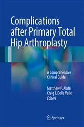 Book cover of Complications after Primary Total Hip Arthroplasty by Matthew P. Abdel
