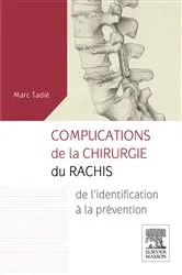 Book cover of Complications de la chirurgie du rachis by Marc Tadié