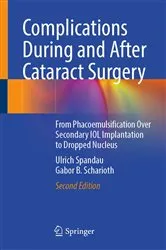 Book cover of Complications During and After Cataract Surgery (2nd ed.) by Ulrich Spandau