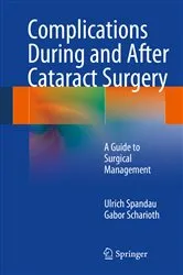 Book cover of Complications During and After Cataract Surgery by Ulrich Spandau
