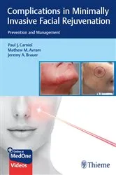 Book cover of Complications in Minimally Invasive Facial Rejuvenation by Paul J. Carniol
