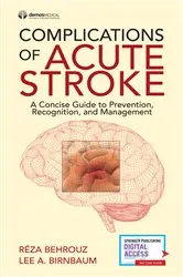 Book cover of Complications of Acute Stroke by Reza Behrouz