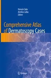 Book cover of Comprehensive Atlas of Dermatoscopy Cases by Horacio Cabo