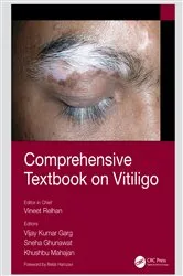 Book cover of Comprehensive Textbook on Vitiligo by Vineet Relhan