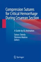 Book cover of Compression Sutures for Critical Hemorrhage During Cesarean Section by Satoru Takeda