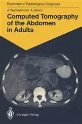 Book cover of Computed Tomography of the Abdomen in Adults by Auguste Wackenheim