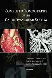 Book cover of Computed Tomography of the Cardiovascular System by Thomas C. Gerber