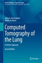 Book cover of Computed Tomography of the Lung (2nd ed.) by Johny A. Verschakelen