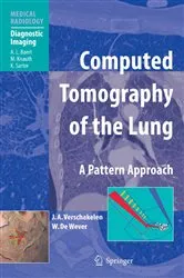 Book cover of Computed Tomography of the Lung by Johny A. Verschakelen
