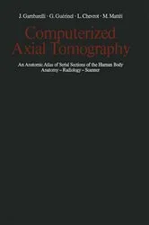 Book cover of Computerized Axial Tomography by R. Galliano
