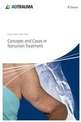 Book cover of Concepts and Cases in Nonunion Treatment by René K. Marti