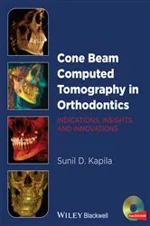 Book cover of Cone Beam Computed Tomography in Orthodontics by Sunil D. Kapila