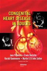 Book cover of Congenital Heart Disease in Adults by Jana Popelova