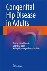 Book cover of Congenital Hip Disease in Adults by George Hartofilakidis