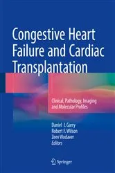 Book cover of Congestive Heart Failure and Cardiac Transplantation by Daniel J. Garry