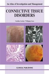 Book cover of Connective Tissue Diseases by C. Gordon
