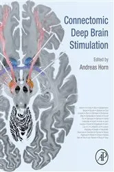 Book cover of Connectomic Deep Brain Stimulation by Andreas Horn