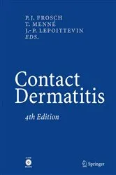 Book cover of Contact Dermatitis (4th ed.) by Peter J. Frosch