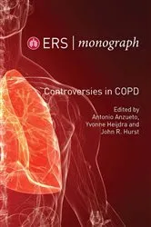 Book cover of Controversies in COPD by Antonio Anzueto