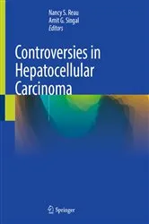 Book cover of Controversies in Hepatocellular Carcinoma by Nancy S. Reau