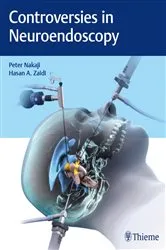 Book cover of Controversies in Neuroendoscopy by Peter Nakaji