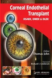 Book cover of Corneal Endothelial Transplant by Thomas John