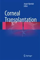 Book cover of Corneal Transplantation by Jesper Hjortdal