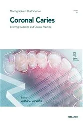 Book cover of Coronal Caries by Joana Christina Carvalho