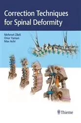 Book cover of Correction Techniques for Spinal Deformity by Mehmet Zileli