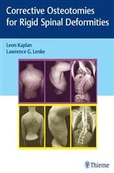 Book cover of Corrective Osteotomies for Rigid Spinal Deformities by Leon Kaplan