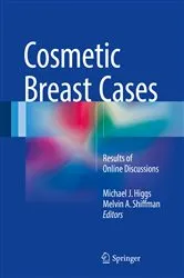 Book cover of Cosmetic Breast Cases by Michael J. Higgs