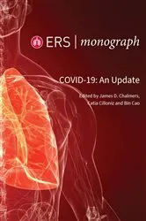 Book cover of COVID-19: An Update by James D. Chalmers
