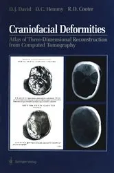 Book cover of Craniofacial Deformities by David J. David