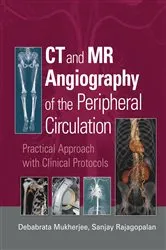 Book cover of CT and MR Angiography of the Peripheral Circulation by Debabrata Mukherjee