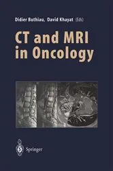 Book cover of CT and MRI in Oncology by Didier Buthiau