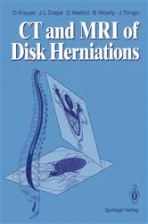 Book cover of CT and MRI of Disk Herniations by Denis Krause