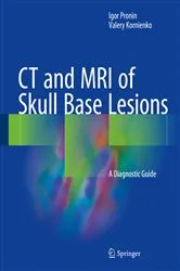 Book cover of CT and MRI of Skull Base Lesions by Igor Pronin