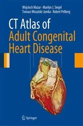 Book cover of CT Atlas of Adult Congenital Heart Disease by Wojciech Mazur