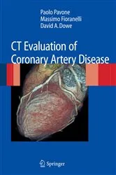 Book cover of CT Evaluation of Coronary Artery Disease by Paolo Pavone